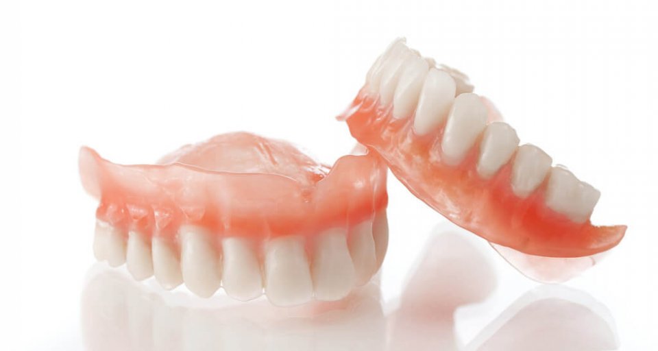 What Are the Benefits of Dental Implants?